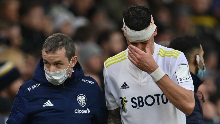 Bielsa defiant over Leeds’ treatment of Koch’s head injury